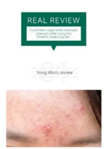 AHA, BHA, PHA 30 Days Miracle Cleansing Bar 1pc - Image 10