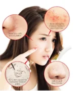AHA, BHA, PHA 30 Days Miracle Cleansing Bar 1pc - Image 3
