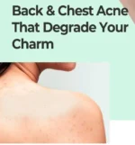 AHA, BHA, PHA Miracle Calming Body Lotion - Image 2