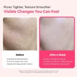 Dr.Melaxin - Cemenrete Cyano Pink Spicule Serum 30ml - Image 7