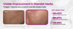 Dr.Melaxin - Cemenrete Picotonic Shot Pigmentation Serum - Image 5