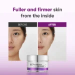 Reedle Shot Lifting Cream - Image 4