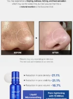 One Day Exosome Shot Pore Ampoule 7500 - Image 3