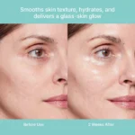 Turnover Ampoule - Image 2